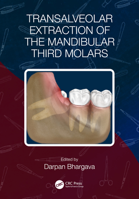 Transalveolar Extraction of the Mandibular Third Molars - Bhargava, Darpan (Editor)