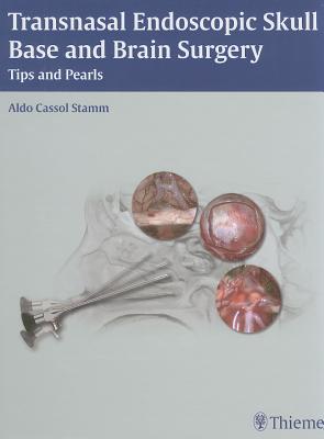 Transnasal Endoscopic Skull Base and Brain Surgery: Tips and Pearls - Stamm, Aldo C (Editor)