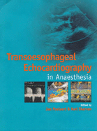 Transoesophageal Echocardiography in Anaesthesia