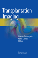 Transplantation Imaging