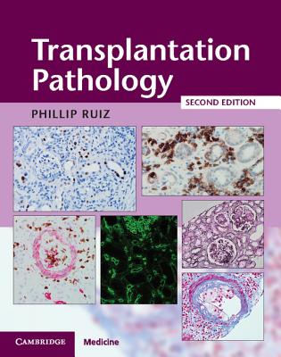 Transplantation Pathology Hardback with Online Resource - Ruiz, Phillip (Editor)