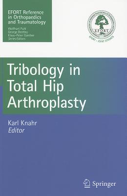 Tribology in Total Hip Arthroplasty - Knahr, Karl (Editor)