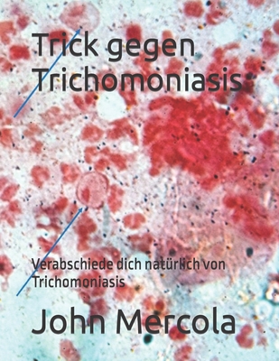 Trick gegen Trichomoniasis: Verabschiede dich natrlich von Trichomoniasis - Mercola, John