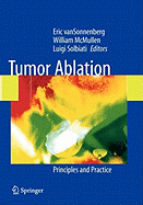 Tumor Ablation: Principles and Practice