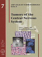 Tumors of the Central Nervous System