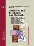 Tumors of the Esophagus and Stomach