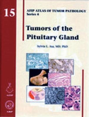 Tumors of the Pituitary Gland: AFIP Atlas of Tumor Pathology, Series 4 - Asa, Sylvia L.