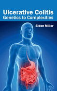 Ulcerative Colitis: Genetics to Complexities