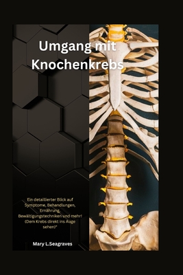 Umgang mit Knochenkrebs: Ein detaillierter Blick auf Symptome, Behandlungen, Ern?hrung, Bew?ltigungstechniken und mehr! (Dem Krebs direkt ins Auge sehen)" - Seagraves, Mary L