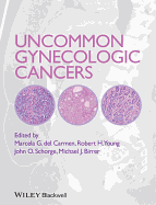 Uncommon Gynecologic Cancers - del Carmen, Marcela (Editor), and Schorge, John O. (Editor), and Young, Robert H. (Editor)