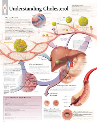 Understanding Cholesterol, Laminated Chart - Scientific Publishing
