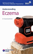 Understanding Eczema