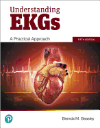 Understanding EKGs: A Practical Approach