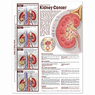 Understanding Kidney Cancer Anatomical Chart