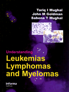 Understanding Leukemias, Lymphomas and Myelomas - Mughal, Tariq, and Goldman, John, and Mughal, Sabena