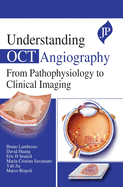 Understanding OCT Angiography: From Pathophysiology to Clinical Imaging