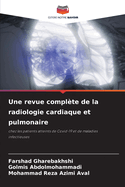 Une revue complte de la radiologie cardiaque et pulmonaire