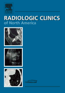 Upper Extremity, an Issue of Radiologic Clinics: Volume 44-4