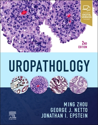 Uropathology - Zhou, Ming, MD, PhD, and Netto, George, MD, and Epstein, Jonathan I