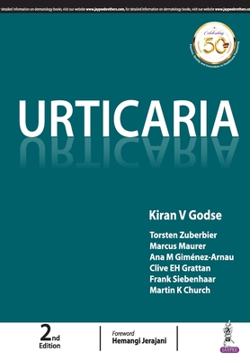 Urticaria - Godse, Kiran V (Editor)