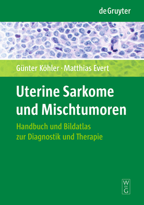 Uterine Sarkome Und Mischtumoren - Khler, G?nter, and Evert, Matthias