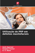 Utiliza??o de PRP em defeitos maxilofaciais