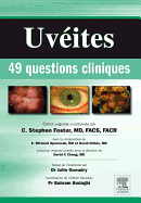 Uveites: 49 Questions Cliniques