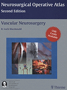 Vascular Neurosurgery