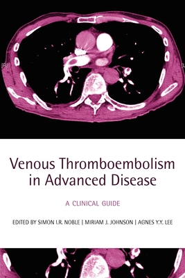 Venous Thromboembolism in Advanced Disease: A Clinical Guide - Noble, Simon I R (Editor), and Johnson, Miriam J (Editor), and Lee, Agnes Y Y (Editor)