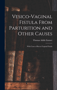 Vesico-Vaginal Fistula from Parturition and Other Causes; With Cases of Recto-Vaginal Fistula