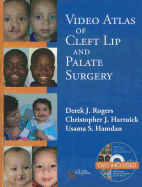 Video Atlas of Cleft Lip and Palate Surgery