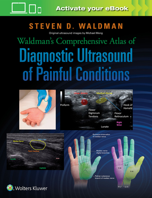 Waldman's Comprehensive Atlas of Diagnostic Ultrasound of Painful Conditions - Waldman, Steven