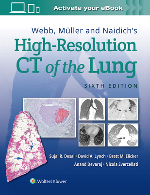 Webb, Mller and Naidich's High-Resolution CT of the Lung - Desai, Sujal, and Lynch, David, and Elicker, Brett M, MD