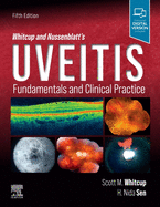 Whitcup and Nussenblatt's Uveitis: Fundamentals and Clinical Practice