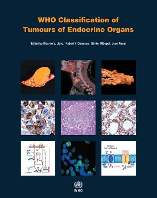 Who Classification of Tumours of Endocrine Organs - Who Classification of Tumours Editorial Board, and Lloyd, Ricardo V (Editor), and Osamura, Robert Y (Editor)