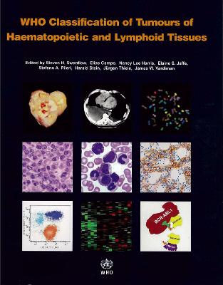 Who Classification of Tumours of Haematopoietic and Lymphoid Tissue [op] - The International Agency for Research on Cancer, and Swerdlow, S (Editor), and Campo, E (Editor)