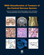 Who Classification of Tumours of the Central Nervous System [Op]