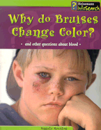 Why Do Bruises Change Color?: And Other Questions about Blood