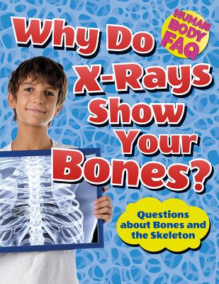 Why Do X-Rays Show Your Bones?: Questions about Bones and the Skeleton - Canavan, Thomas