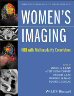 Women's Imaging: MRI with Multimodality Correlation
