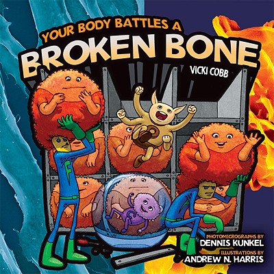 Your Body Battles a Broken Bone - Cobb, Vicki, and Kunkel, Dennis (Photographer)